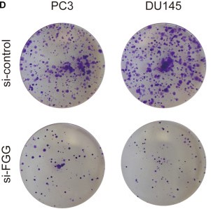 Colony formation assays shows that FGG knockdown.jpg
